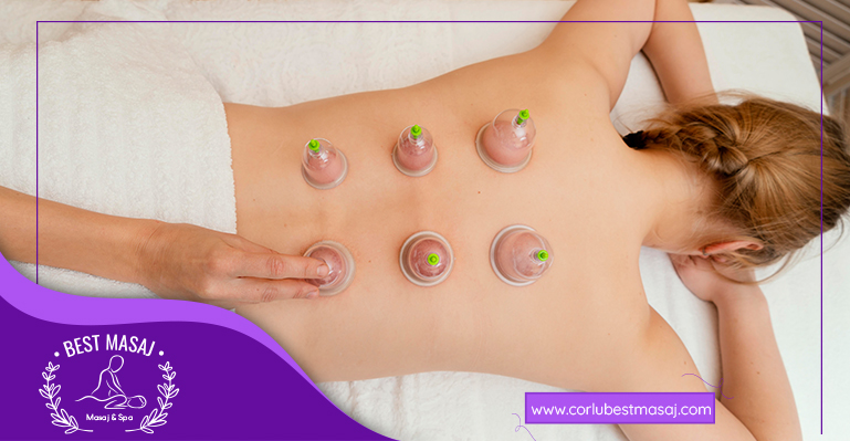 Cupping Masajı Çorlu